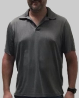The same patient photographed after his weight loss programme, front view