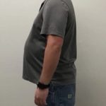 Weight Loss Before & After Patient #255