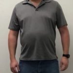 Weight Loss Before & After Patient #255