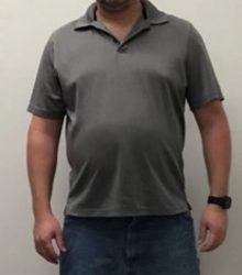 Weight Loss Before & After Patient #255