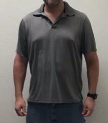 Weight Loss Before & After Patient #255