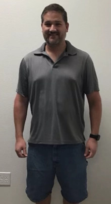 Weight Loss Before & After Patient #255