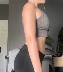 Weight Loss Before & After Patient #266