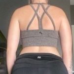 Weight Loss Before & After Patient #266