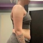 Weight Loss Before & After Patient #266