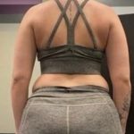 Weight Loss Before & After Patient #266