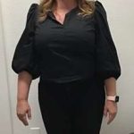 Weight Loss Before & After Patient #250