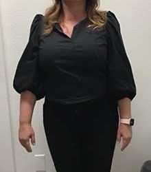 Weight Loss Before & After Patient #250