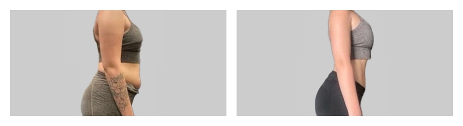 bna-example